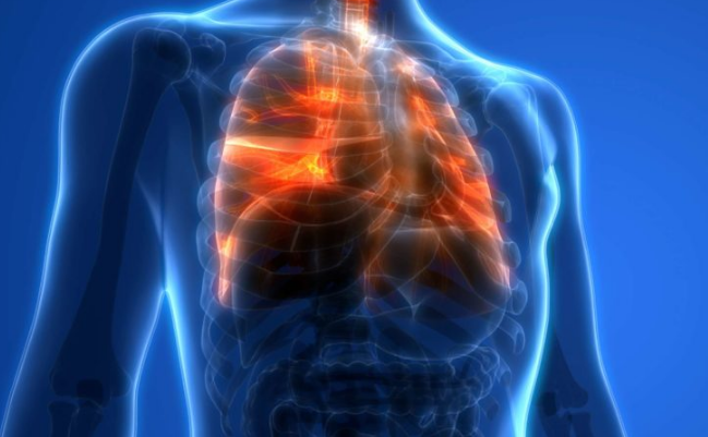 Chronic Lower Respiratory Disease
